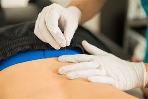 Punción Seca Ecoguiada - Imagen 2