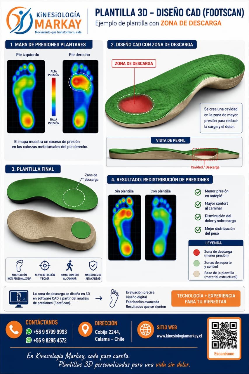Plantillas Ortopédicas 3D Footscan - Imagen 4